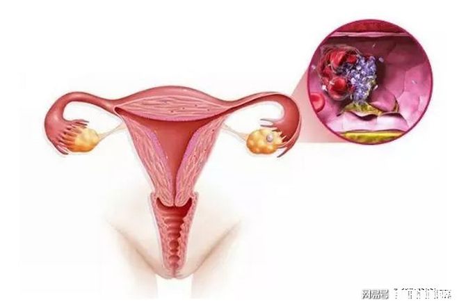 代孕包生龙凤胎